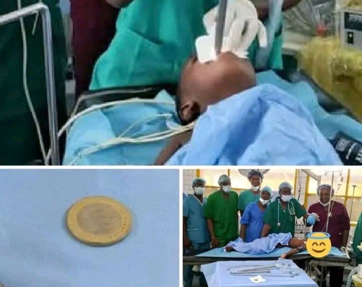Burkina Faso : Dédougou, extraction réussie d’une pièce de 500 f dans l’œsophage d’un enfant de 4 ans