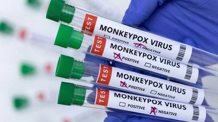 Espagne : Des cas de variole du singe détectés dans un salon de tatouage en Andalousie