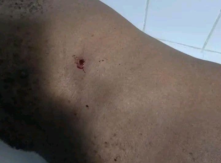 Côte d'Ivoire : Plateau, des tirs d'armes à feu font plusieurs blessés