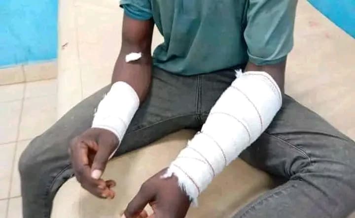 Côte d'Ivoire : Duekoué, un acte de torture révélé sur un vigile électrocuté