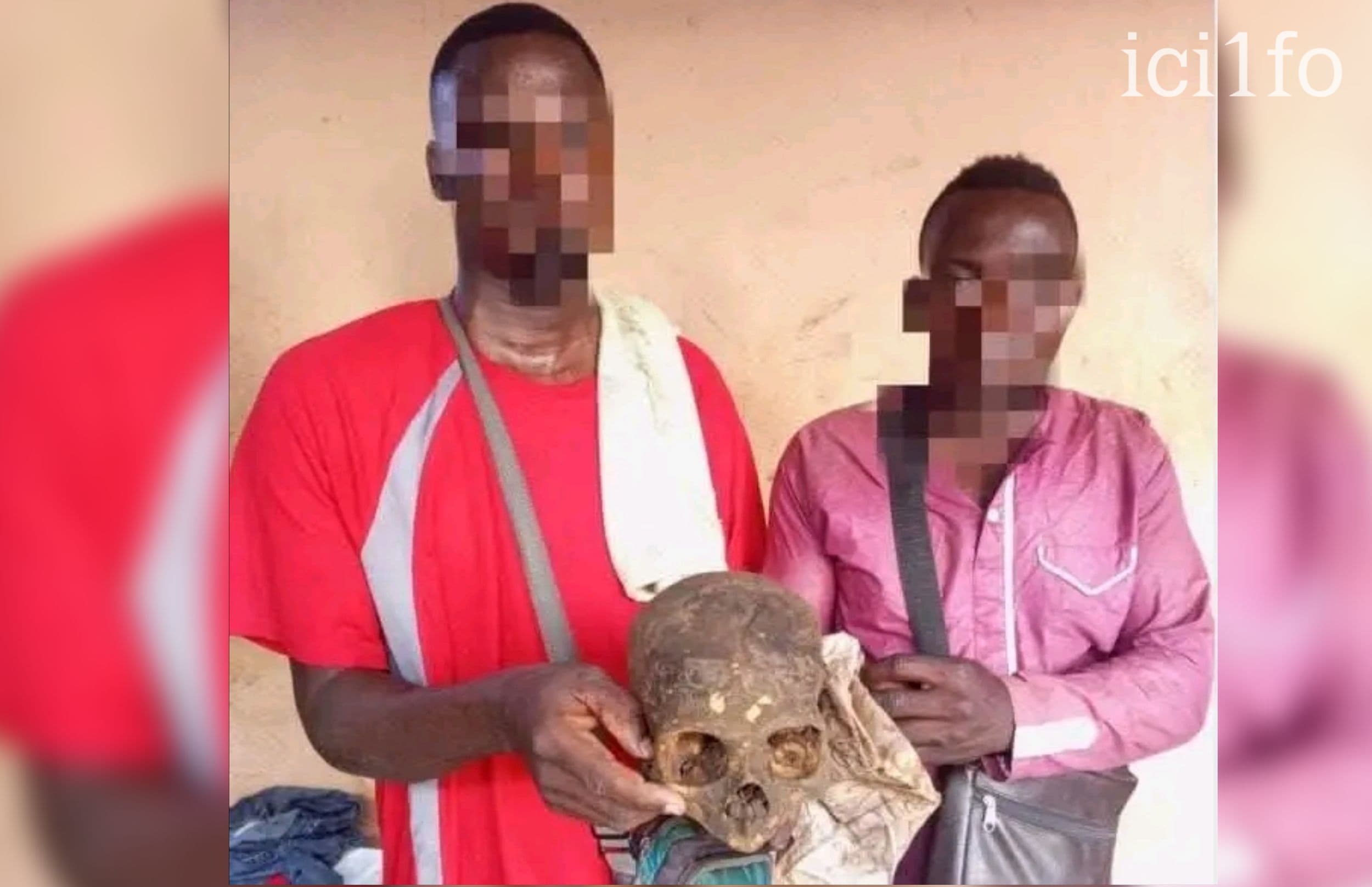 Bénin : Godomey, deux hommes en possession d'un crâne humain mis aux arrêts 