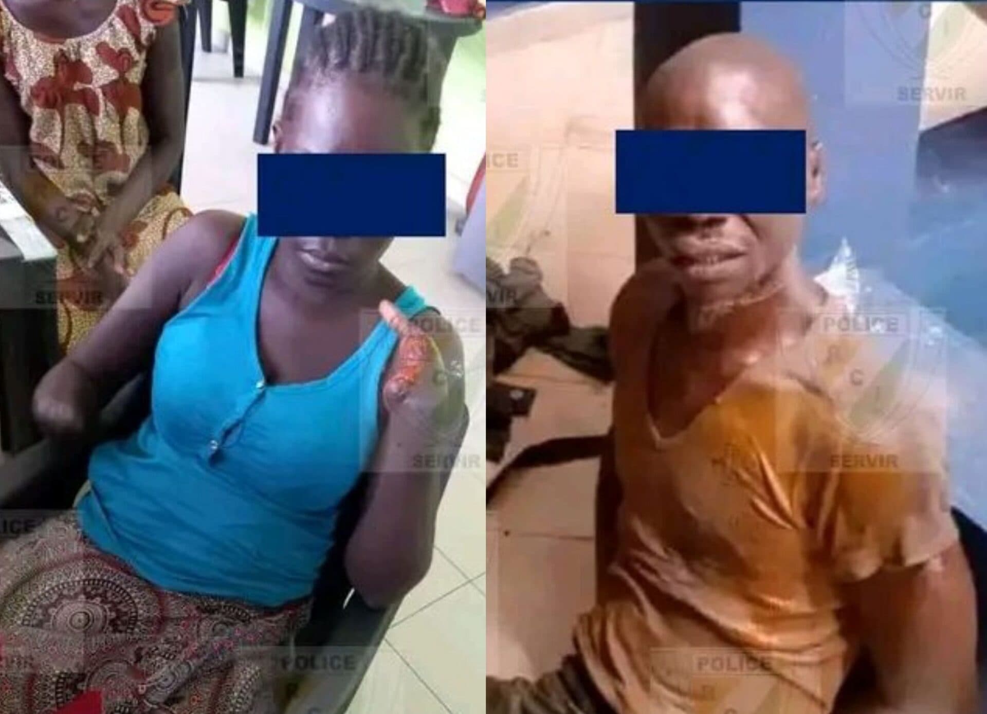 Côte d'Ivoire : Affery, l'auteur de la mutilation de mains et tentative d'homicide de sa concubine interpellé